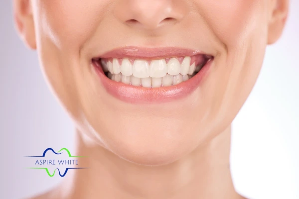 Follow your teeth whitening aftercare Marlow to prolong your whiter smile!