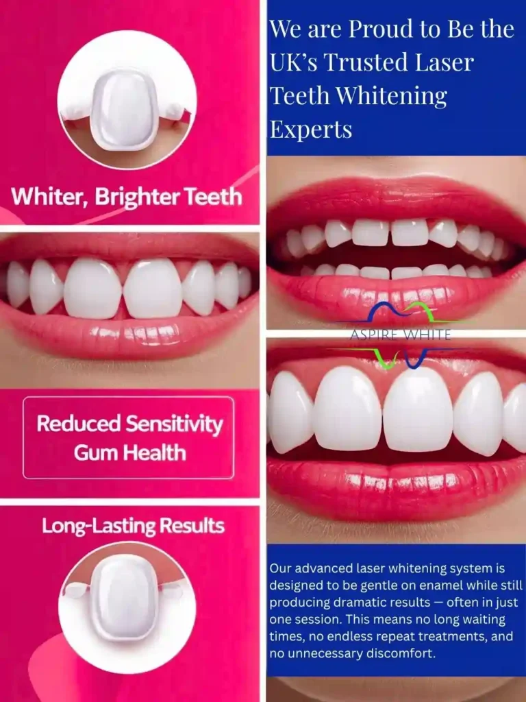 We are Proud to Be the UK’s Trusted Laser Teeth Whitening Experts Marlow